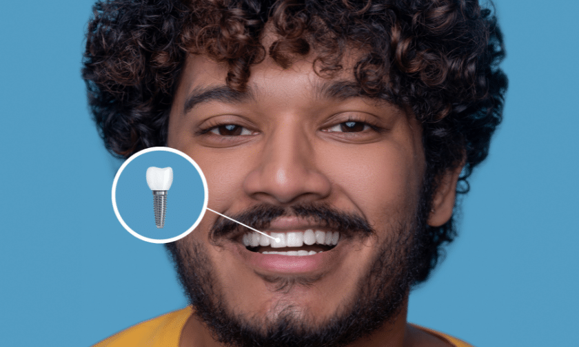 Featured image for “When is Dental Implant Surgery Needed?”