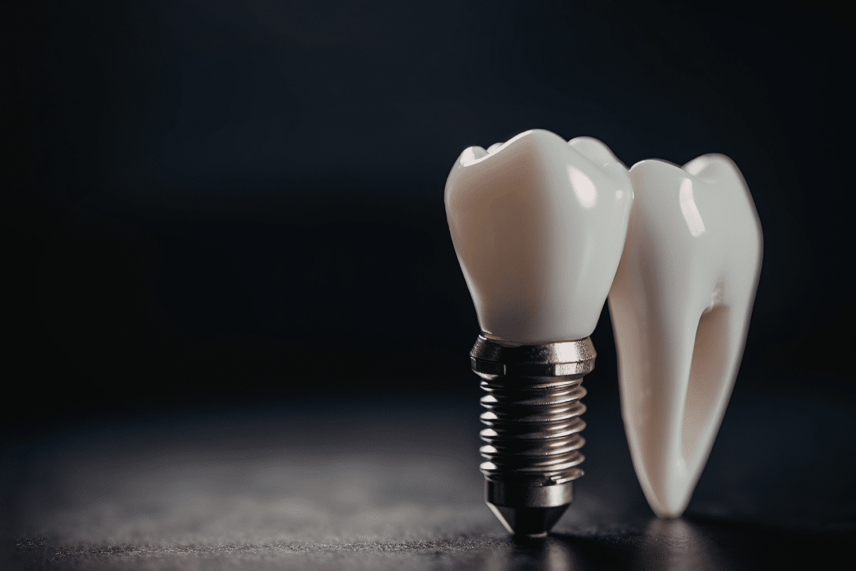 Featured image for “Single Tooth Dental Implant: Why It’s About More Than a Better Smile”
