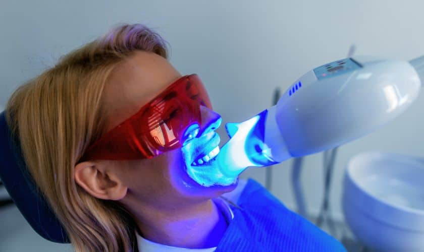 Featured image for “Find Professional Teeth Whitening Options Available In Syracuse”