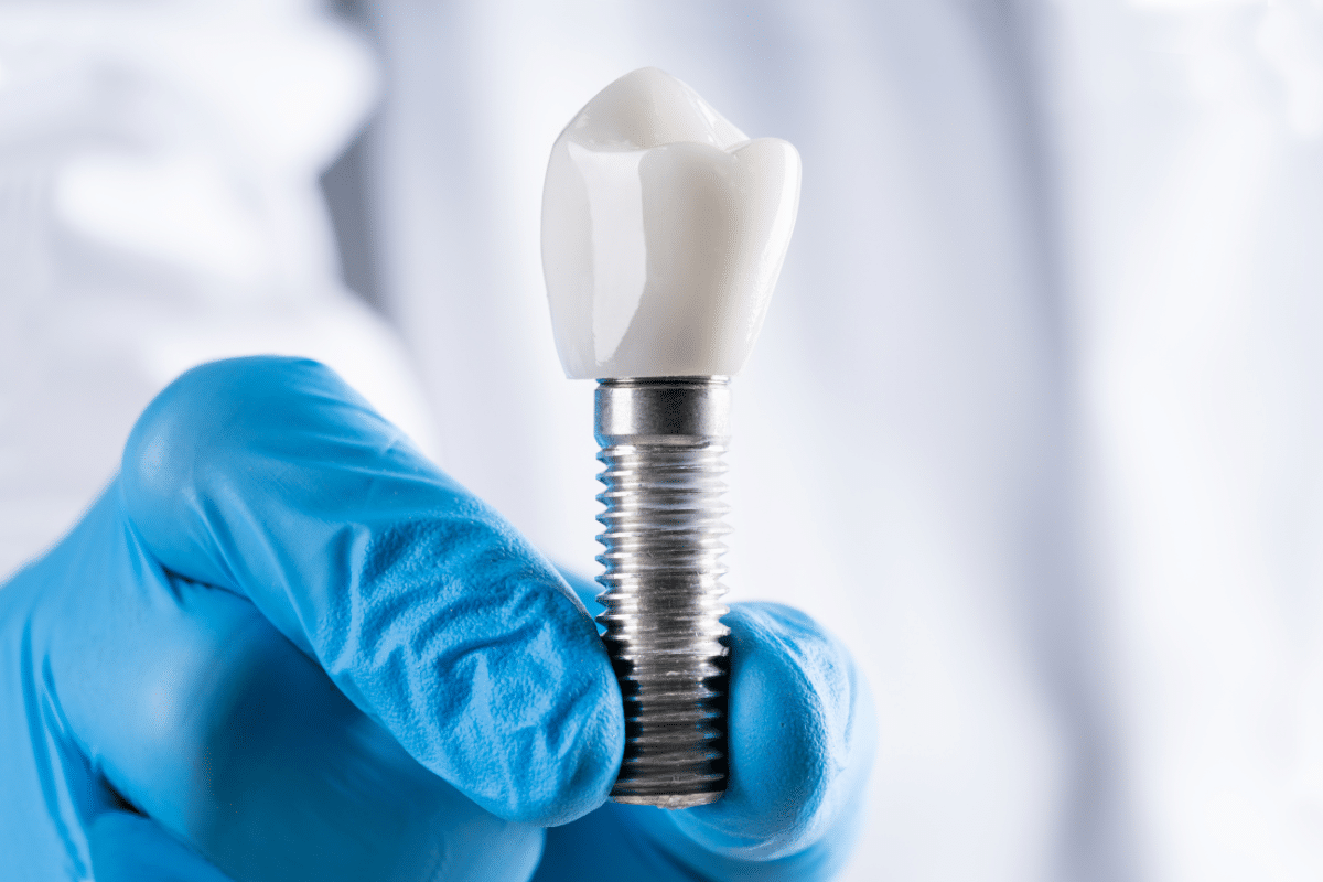 Featured image for “Dental Implant Alternatives: 10 Options for Replacing Missing Teeth”