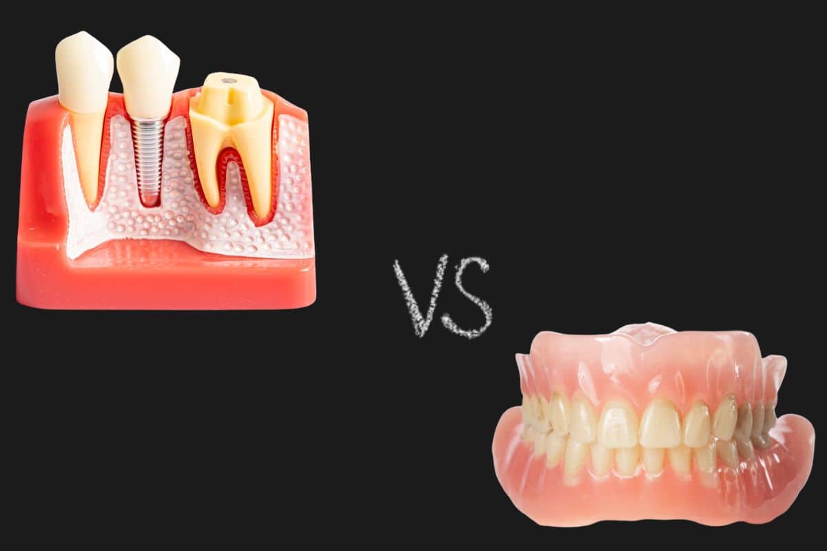 Featured image for “All-On-4 Dental Implants vs. Dentures: Which Is Right for You?”