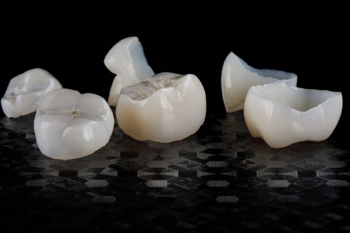 Featured image for “What Should You Do If Your Dental Crown Falls Off?”