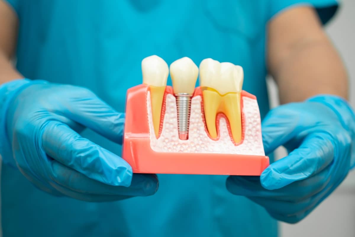Featured image for “Which Dental Implant Treatment Is The Most Suitable For Your Needs?”