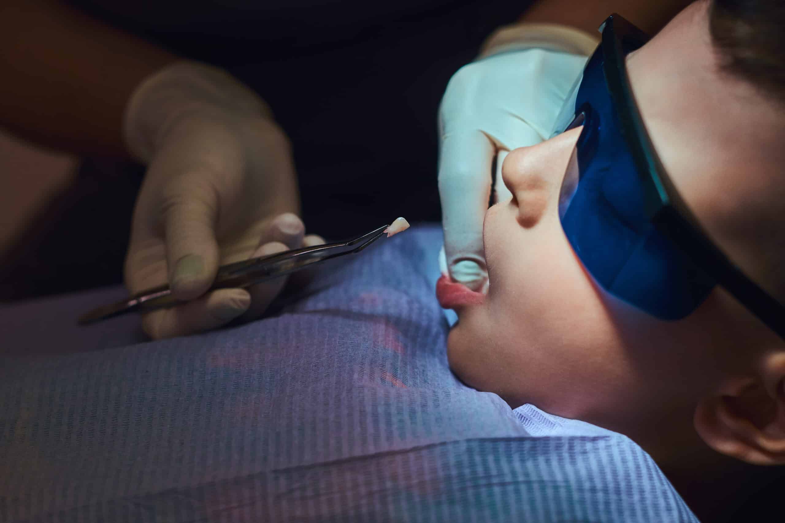 Featured image for “Enhancing Your Smile: The Power of Implanting a Back Tooth”