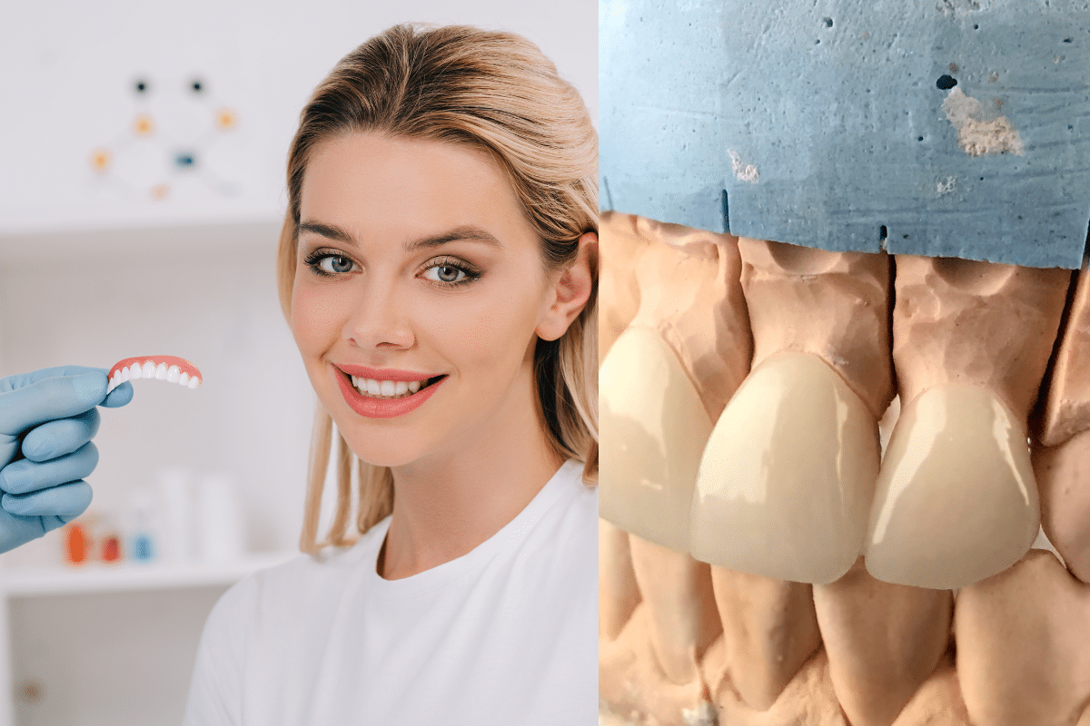 Featured image for “Teeth Whitening vs Veneers: Which Treatment Is Right for Discolored Teeth?”